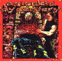 Amoebic Dysentery : Mongoloid Metal